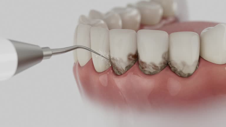 Reliable Emergency Dentist contractor in Flossmoor, IL by Smile Center Dentistry